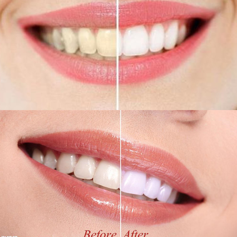 Bambusowy węgiel drzewny zęby  – Teeth Whitening Zimba recenzja i cena