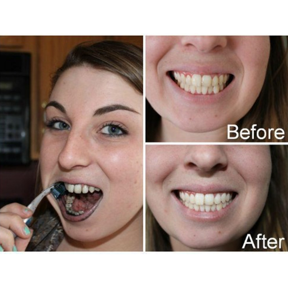 Bambusowy węgiel drzewny zęby  – Teeth Whitening Zimba recenzja i cena