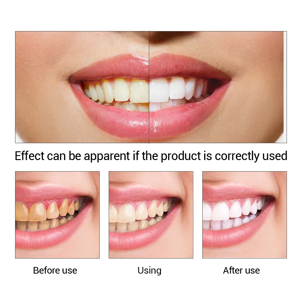 FTEENPLY esencja do wybielania – Teeth Whitening Zimba recenzja i cena