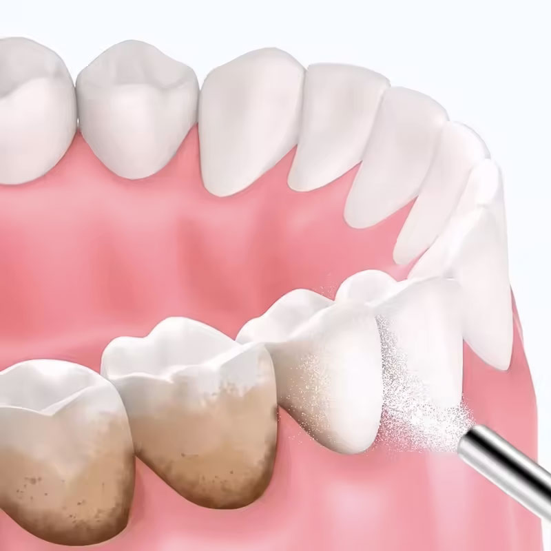 130g Proszek do piaskowania zę – Teeth Whitening Zimba recenzja i cena