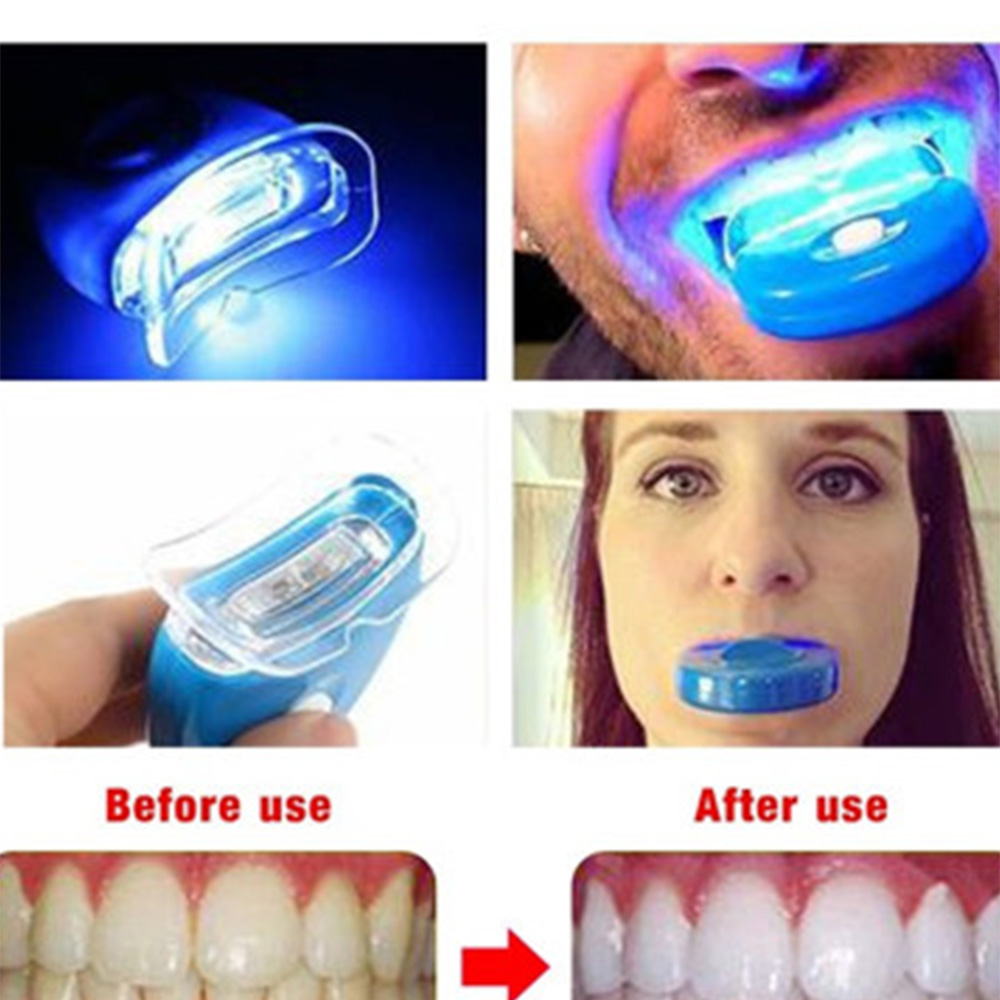 Nowy niebieski Led wybielanie  – Teeth Whitening In Office recenzja i cena